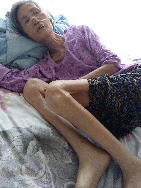 Gospođa Zhao nakon što je bila puštena iz zatvora, teško iscrpljena i bez prednjeg zuba, koji joj je izbijen dok je bila prisilno hranjena nepoznatim supstancama.