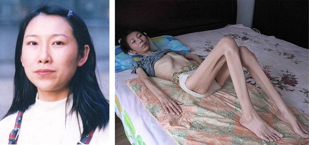 Prije (lijevo) i poslije (desno), gospođa Zhao Ye je bila progonjena zbog svoje vjere u Falun Gong
