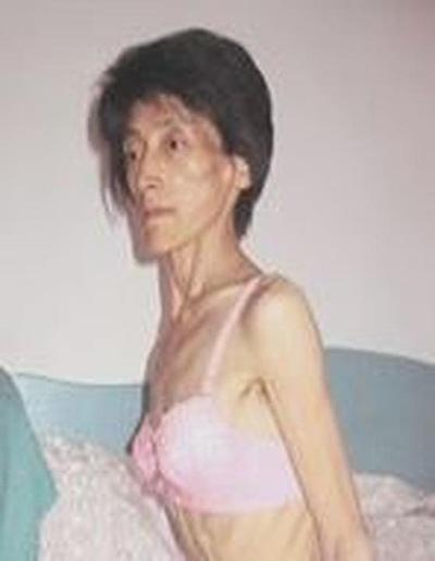  Gospođa Song Yanqun nakon pretrpljenih decenija zlostavljanja i mučenja u zatvoru