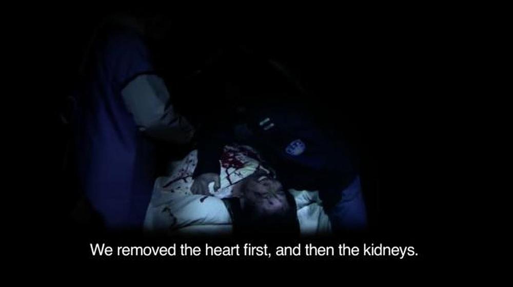 "Prvi smo uklonili srce, a zatim bubrege", rekao je policajac koji je bio očevidac prisilnog oduzimanja organa od živih ljudi. (scena iz filma)